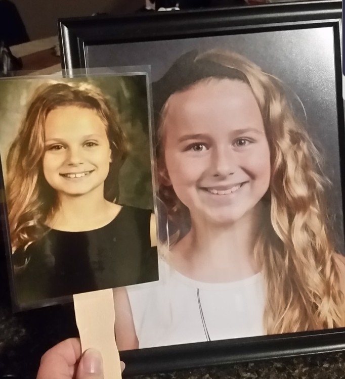 Keira, left,and Joslynn, received Keira's liver. The two share an uncanny resemblance.