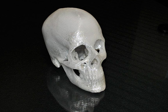 rp+m recreates CT scans of human skulls with trauma injuries to aid surgeons in preparing for complex surgeries